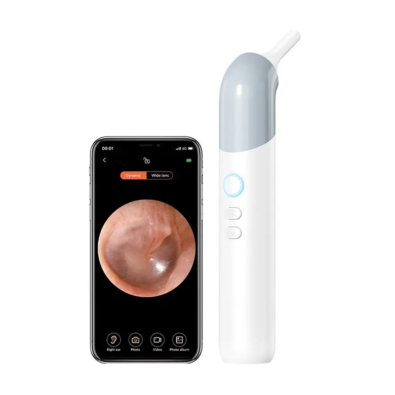 3-in-1-Smart-Ohrreiniger mit H – Pet Ear Cleaner Bewertung und Preis